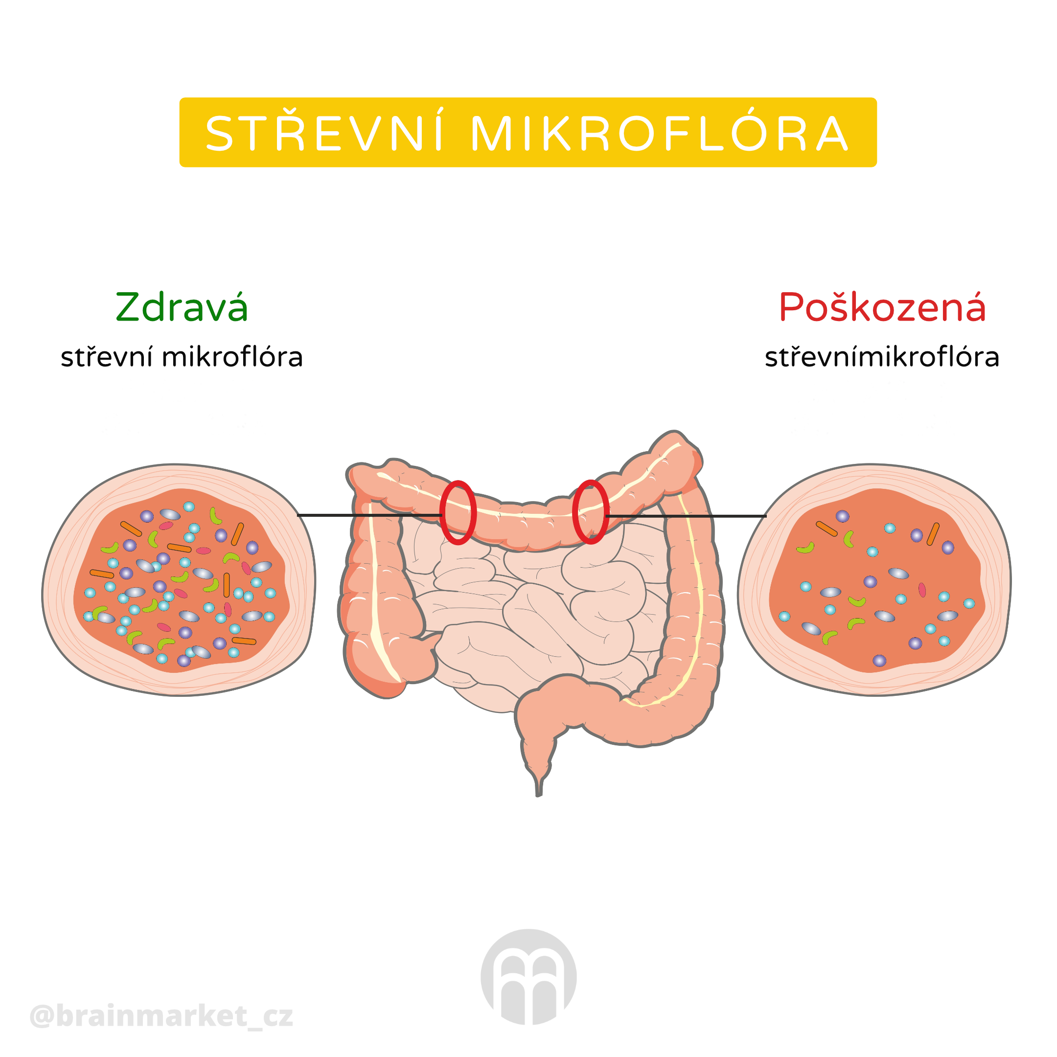 strevni mikroflora_infografika_cz